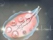 子宫纵隔生育困难可以在江苏省做三代试管吗？子宫有问题做试管的成功率高吗？